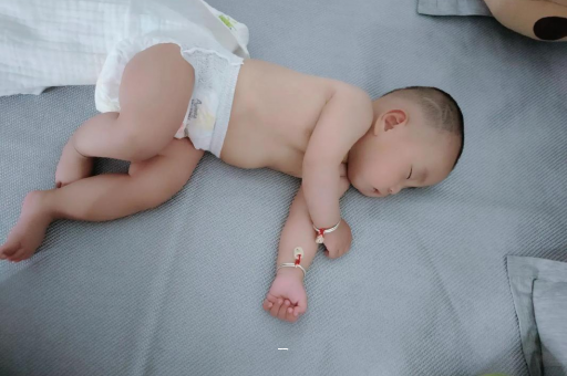 绥化宝宝脸上有白色斑块